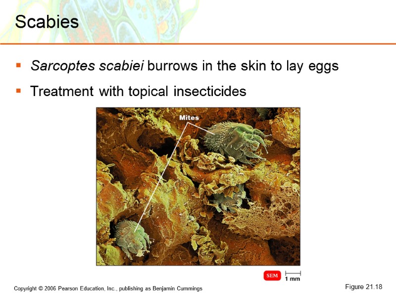 Scabies Sarcoptes scabiei burrows in the skin to lay eggs Treatment with topical insecticides